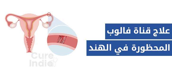 علاج انسداد قناة فالوب في الهند